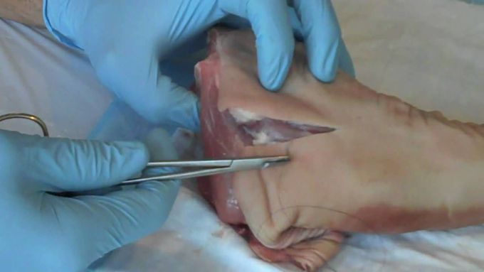 Suture - Basic Technique 1