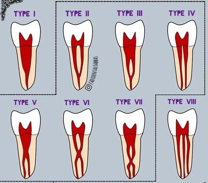 Vertuccis classifcation