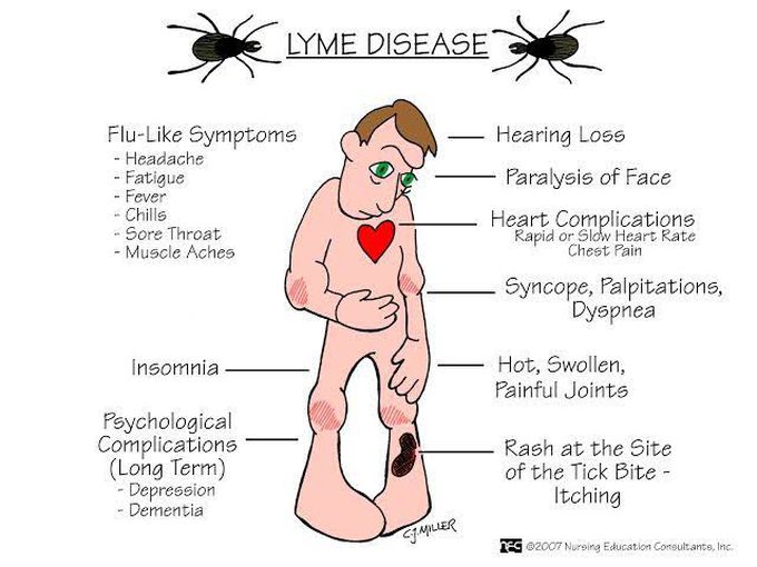 Lyme Disease