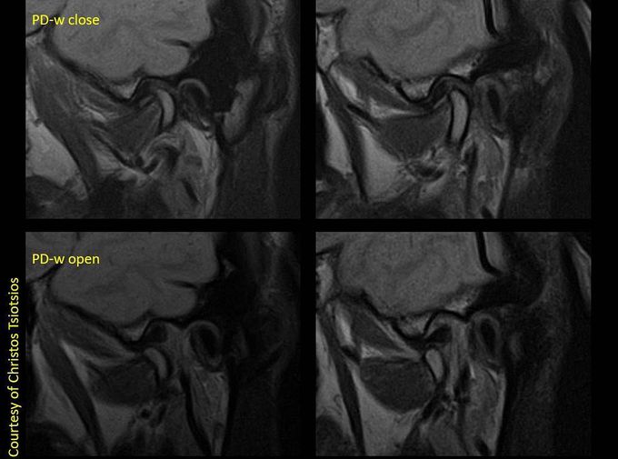 Magnetic Resonance Imaging (MRI)