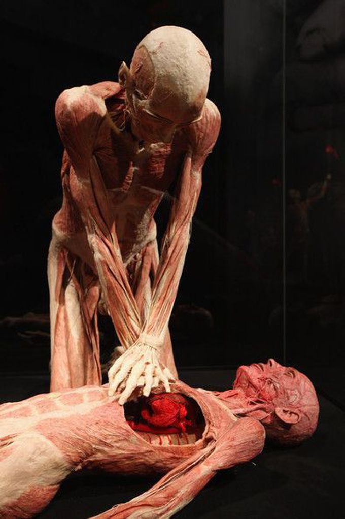 Body Worlds Exhibition