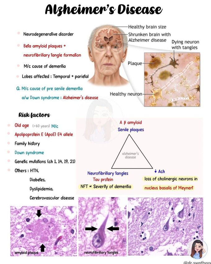 Alzheimer's Disease I