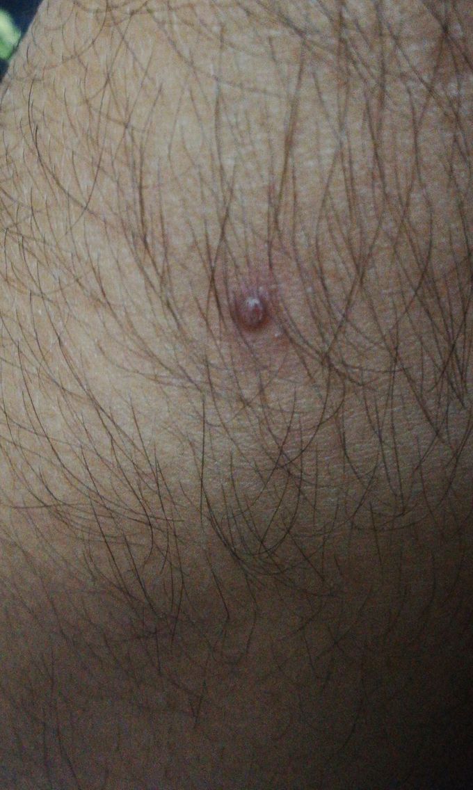 Diagnosis?