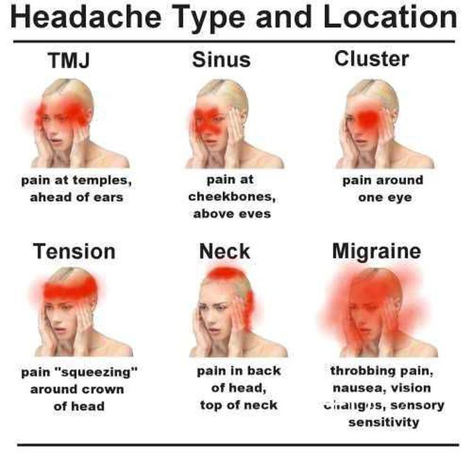Headache type and location