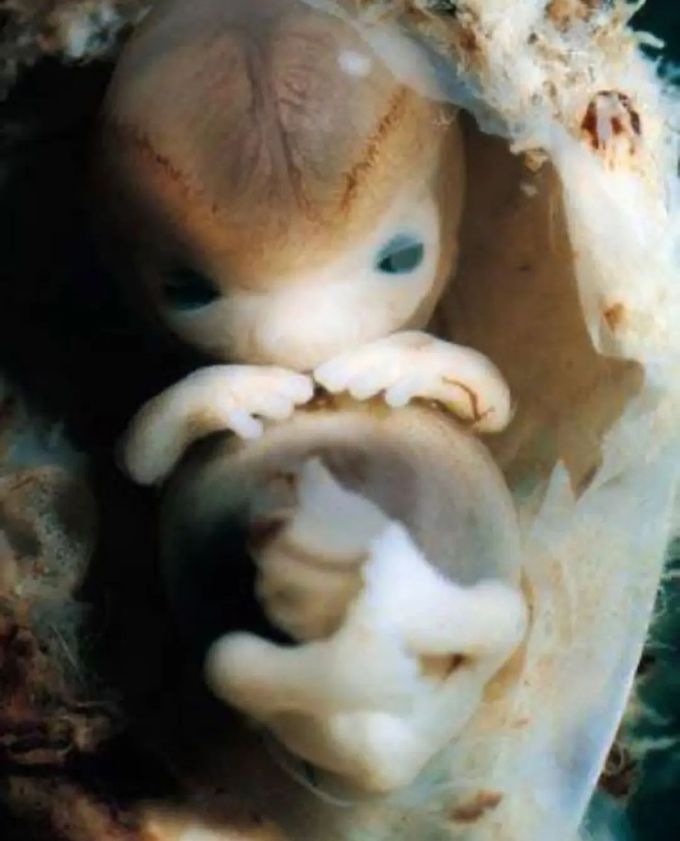 Human embryo at 7 week Gestation