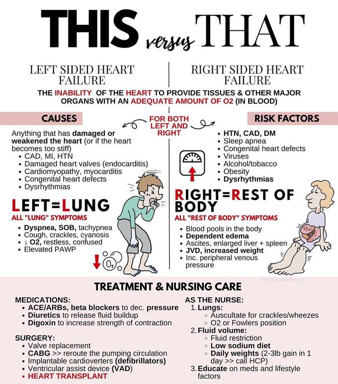 Left Sided Heart Failure Vs Right Sided Heart Failure