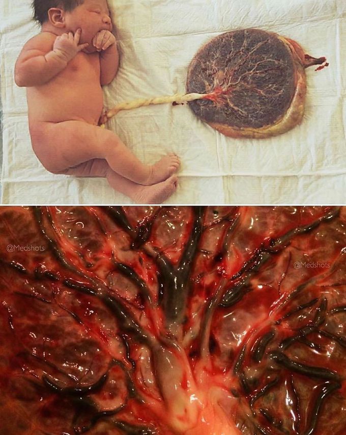 Human placenta, where life begins! 