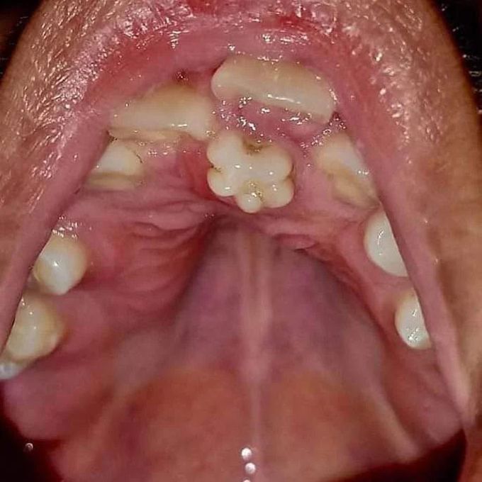What is this condition called?