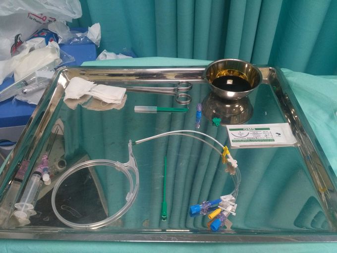 Central venous catheter