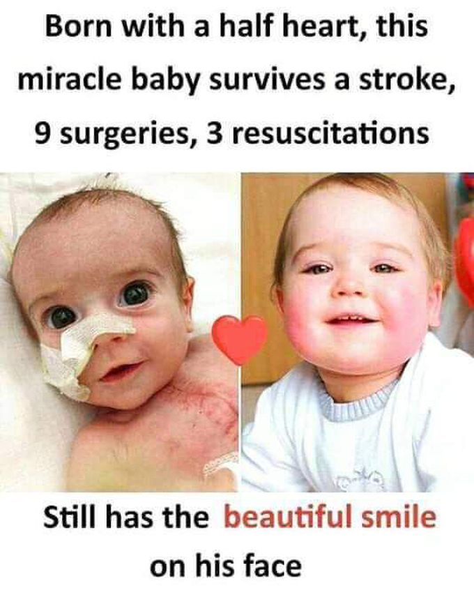 Miracle baby 👶