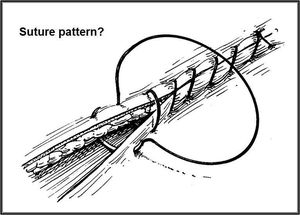 What kind of suture pattern is depicted? - MEDizzy