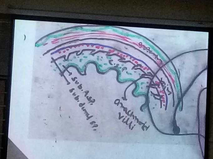 Brain