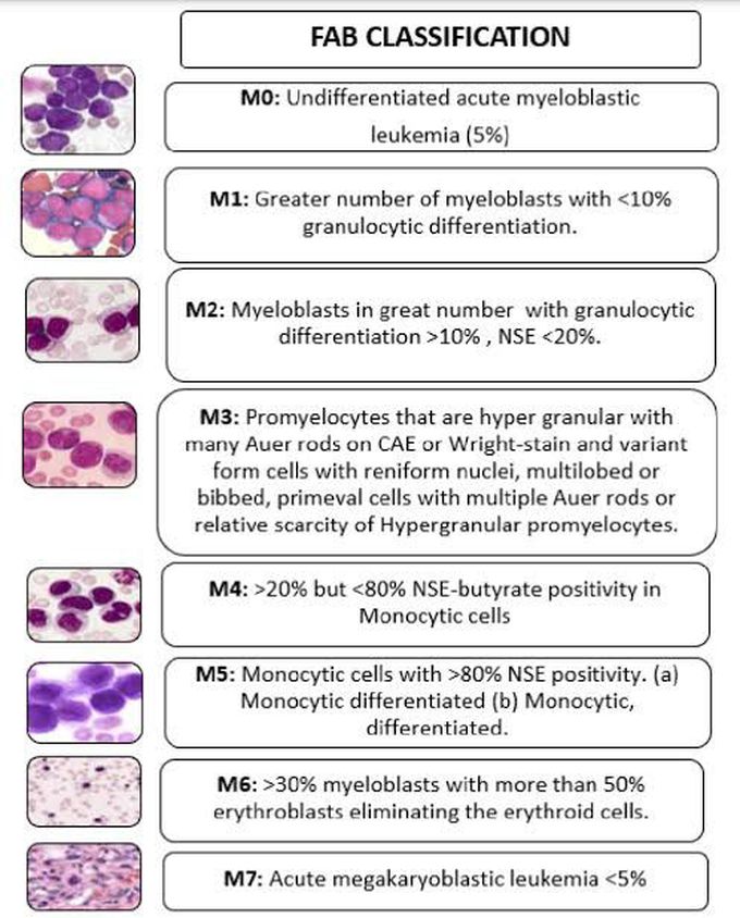 FAB classification of AML