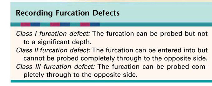 Furcation defects