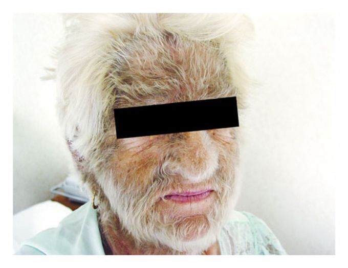 What is your diagnosis
