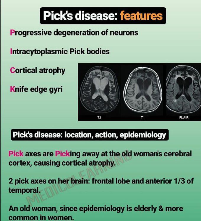 Features of pick's disease