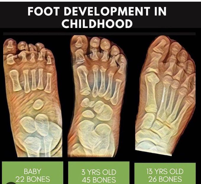 Foot Development in Childhood