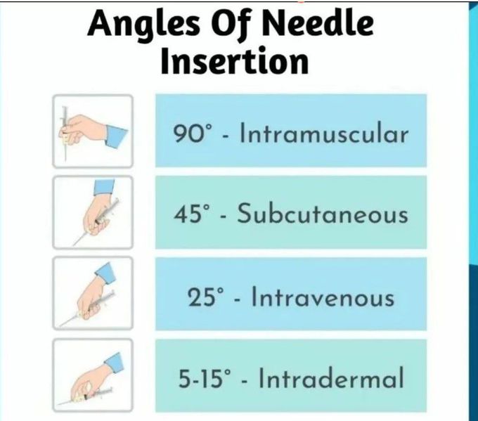 Angles of Needle Insertion