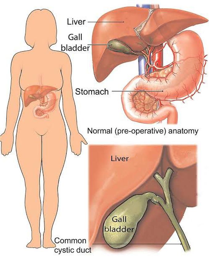 Causes of cholecystitis