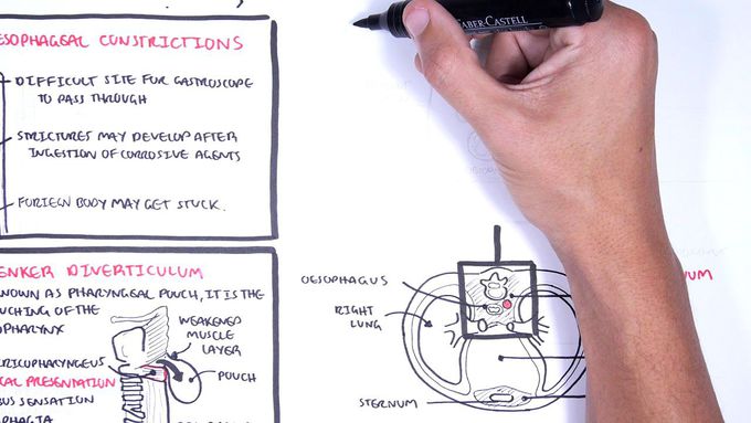 Clinical Anatomy - Oesophagus (esophagus)