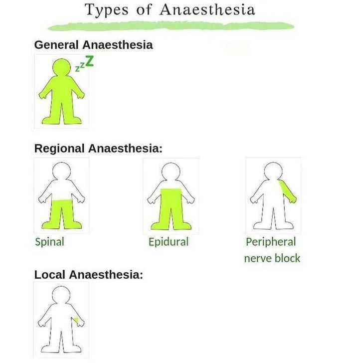 Types of anesthesia