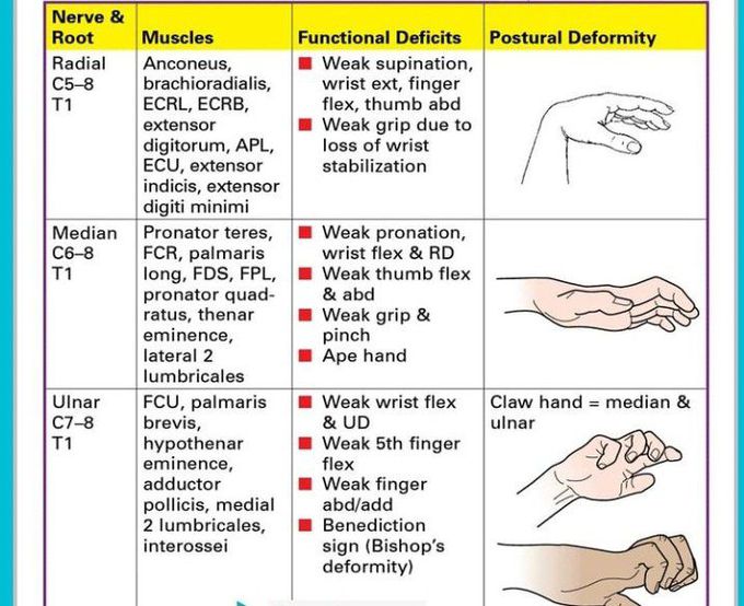 Brachial plexus