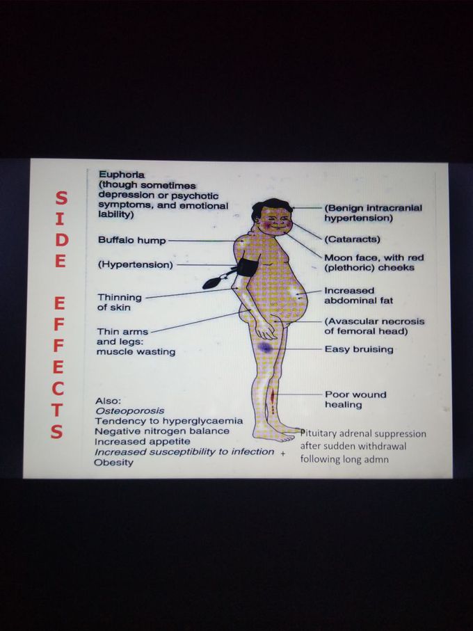 Side effects of what drug is shown in picture?