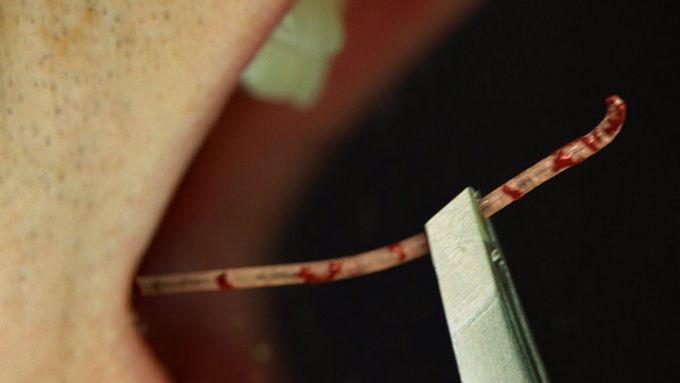 Watch This Biologist Remove A Parasite From His Own Mouth