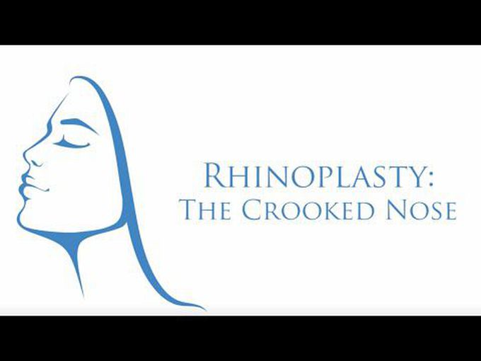 Causes for Rhinoplasty