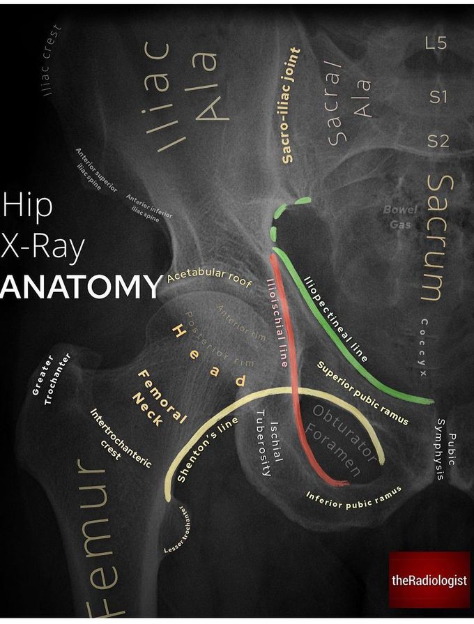 Hip X-ray Anatomy