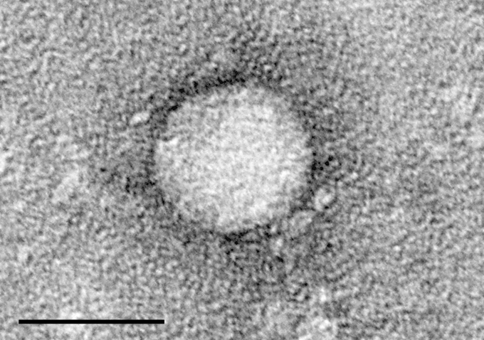 New hepatitis C drugs mean diseased organs can be used for transplants