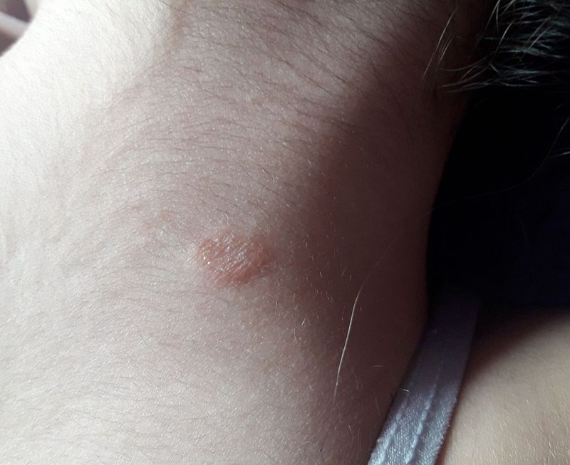 Please say me what is this? - MEDizzy