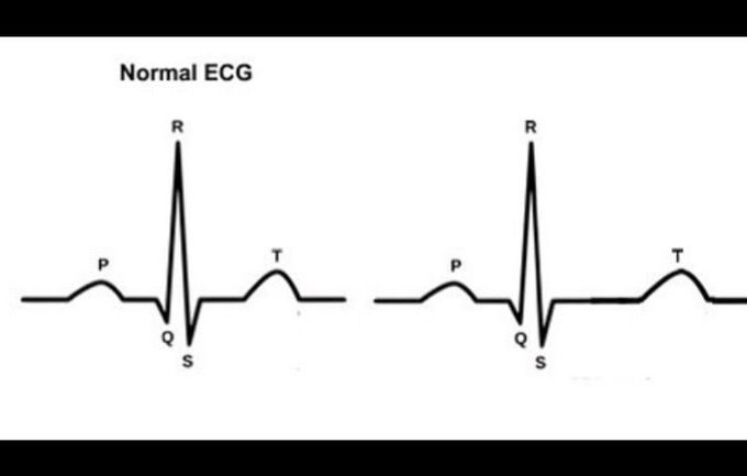 Guess the diagnosis !!