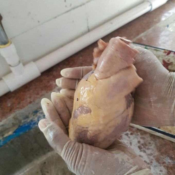 Human heart