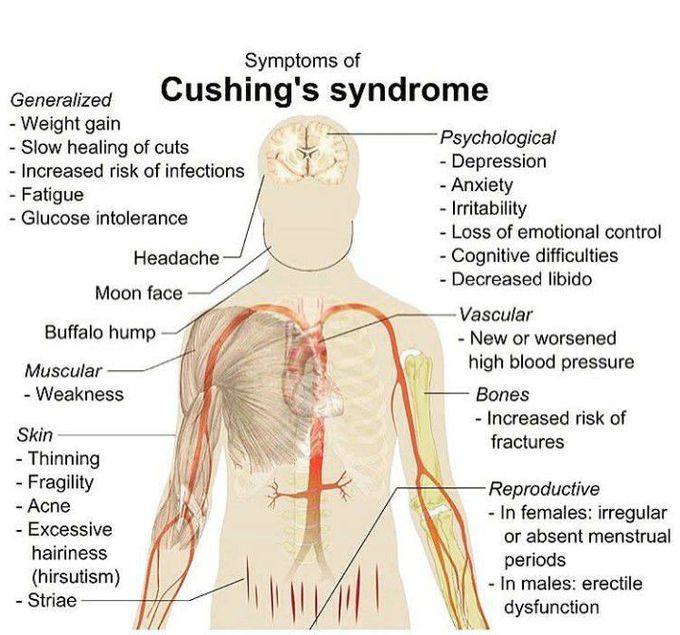 Clinical features of Cushing's syndrome