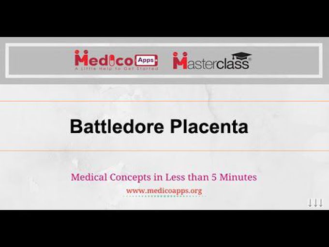 Battledore placenta