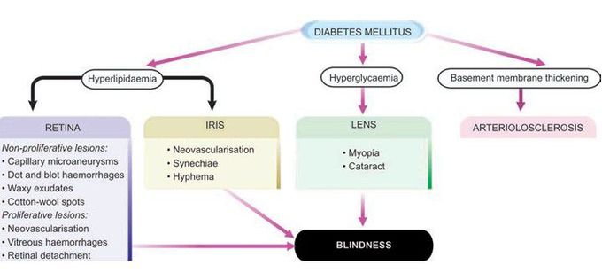 Diabetes mellitus