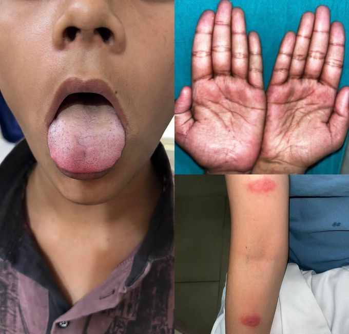 Identify the Condition