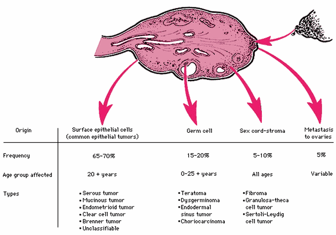 Ovarian cancer classification