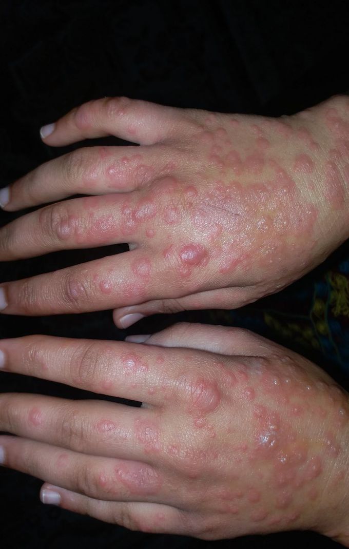 What's your diagnosis?