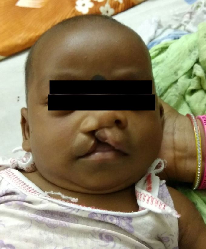 Diagnosis?