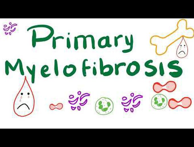 Primary Myelofibrosis