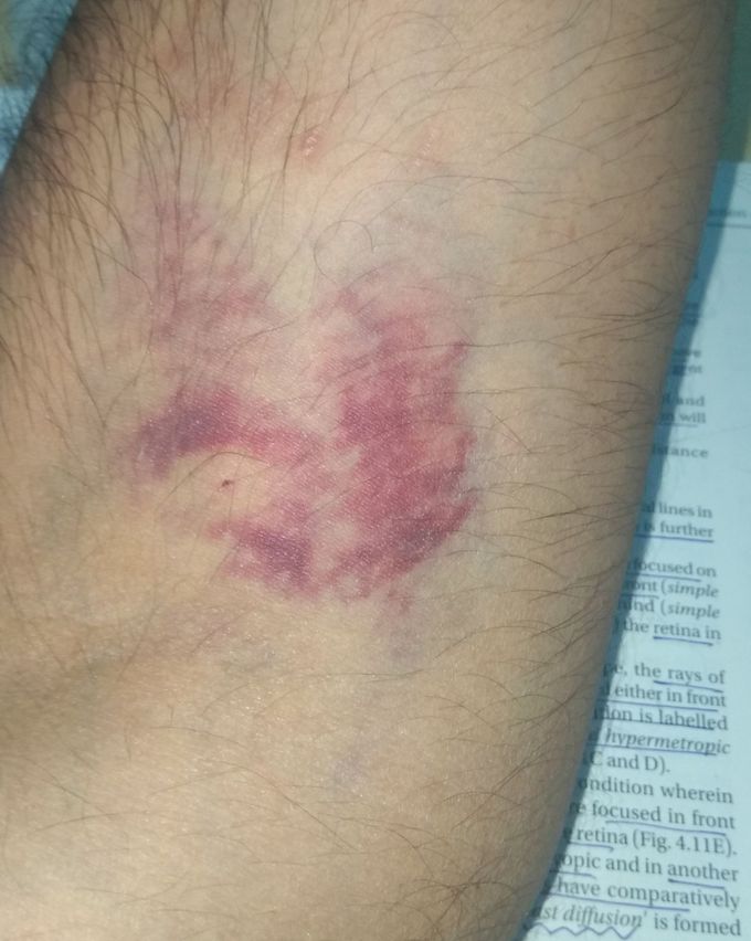 Diagnose the case??