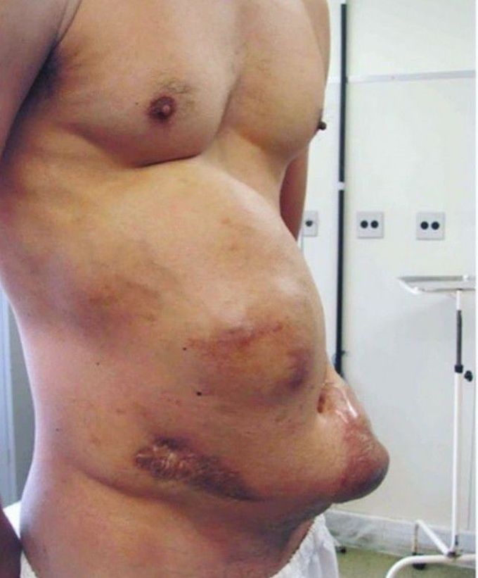 general trauma surgery
