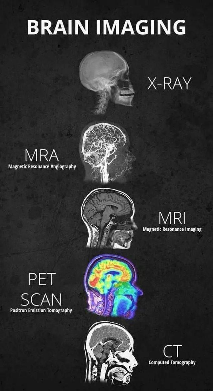BRAIN IMAGING