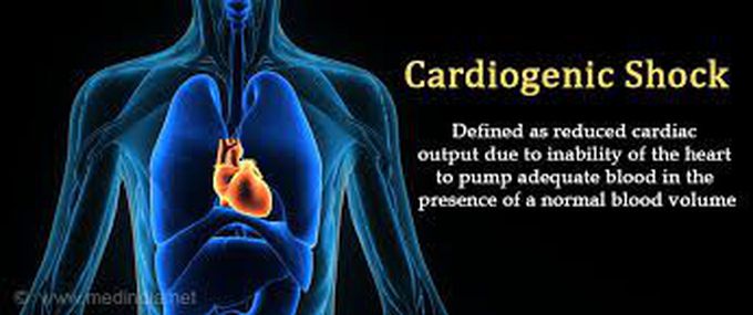 Symptoms of cardiogenic shock