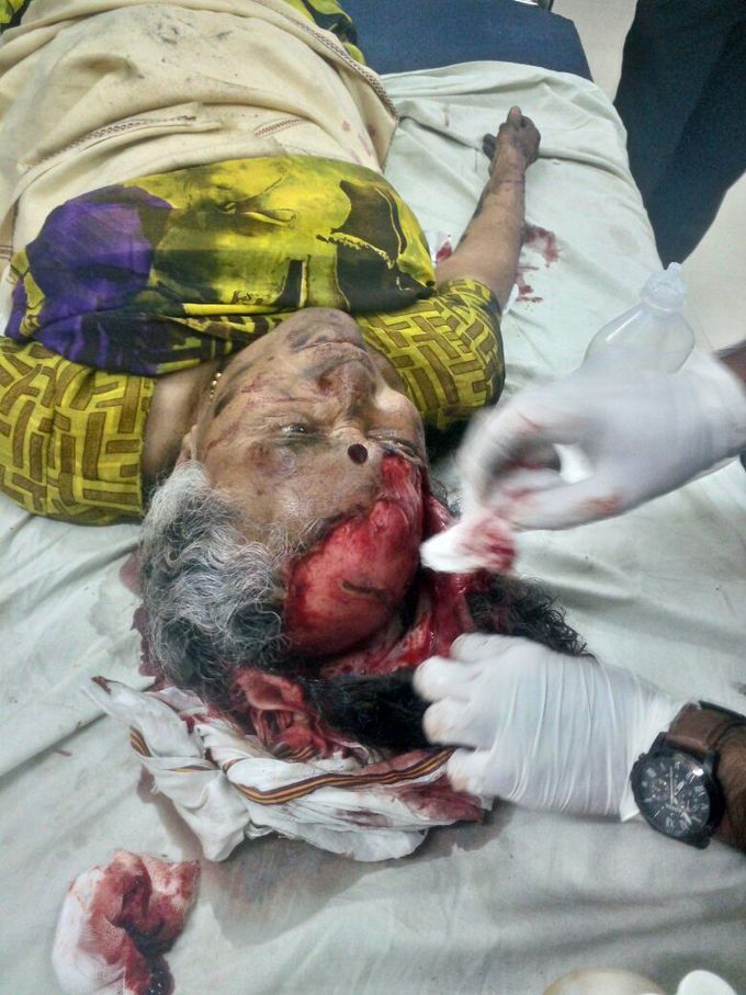 Accident case   conscious and oriented😮😮