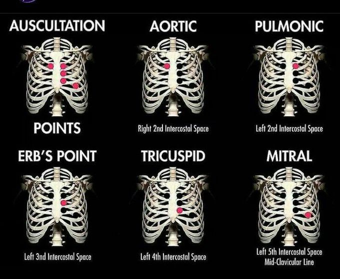 Auscultation points