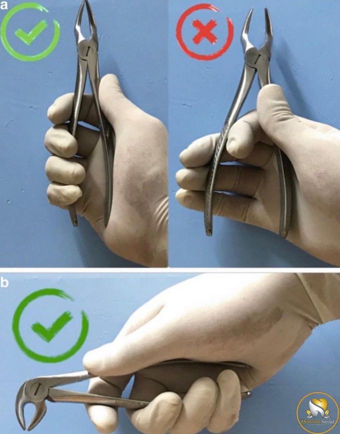 Dental Forceps