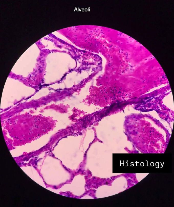 Alveoli Histology